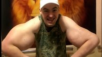 "Руският Попай", който си инжектира вазелин в бицепсите, може да загуби ръцете си 