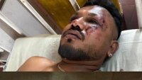 Оцелелият от самолета на Air India Рамеш: Самолетът се разцепи на две, преди да удари земята