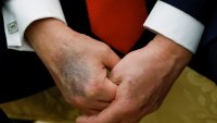 Поредната голяма синина по ръцете на Тръмп предизвика безпокойство