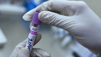 В 27 региона на Русия има епидемия от ХИВ