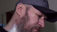 Украинският войник, прекарал 491 дни сам на фронта: Вече се смятах за мъртъв ВИДЕО