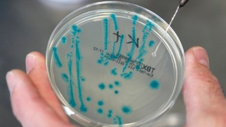 Във Франция откриха Е.coli от същия щам като в Германия