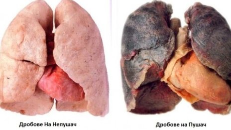 Смъртта ни дебне върху 65% от кутиите на цигарите