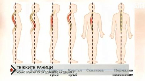 Болка в гърба - един от основните проблеми за хората