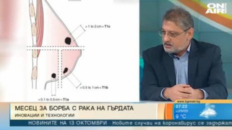 Нова приставка определя стадия при рак на гърдата