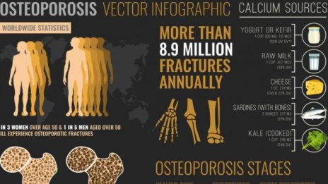 76% от жените над 50 години у нас не получават навременно лечение за остоепороза