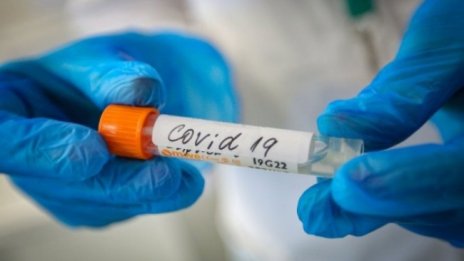 8012 са новите случаи на COVID-19, 176 души са починали